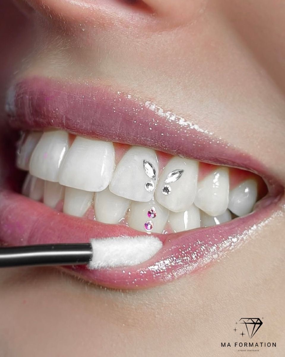 Neelazur - réalisation 6