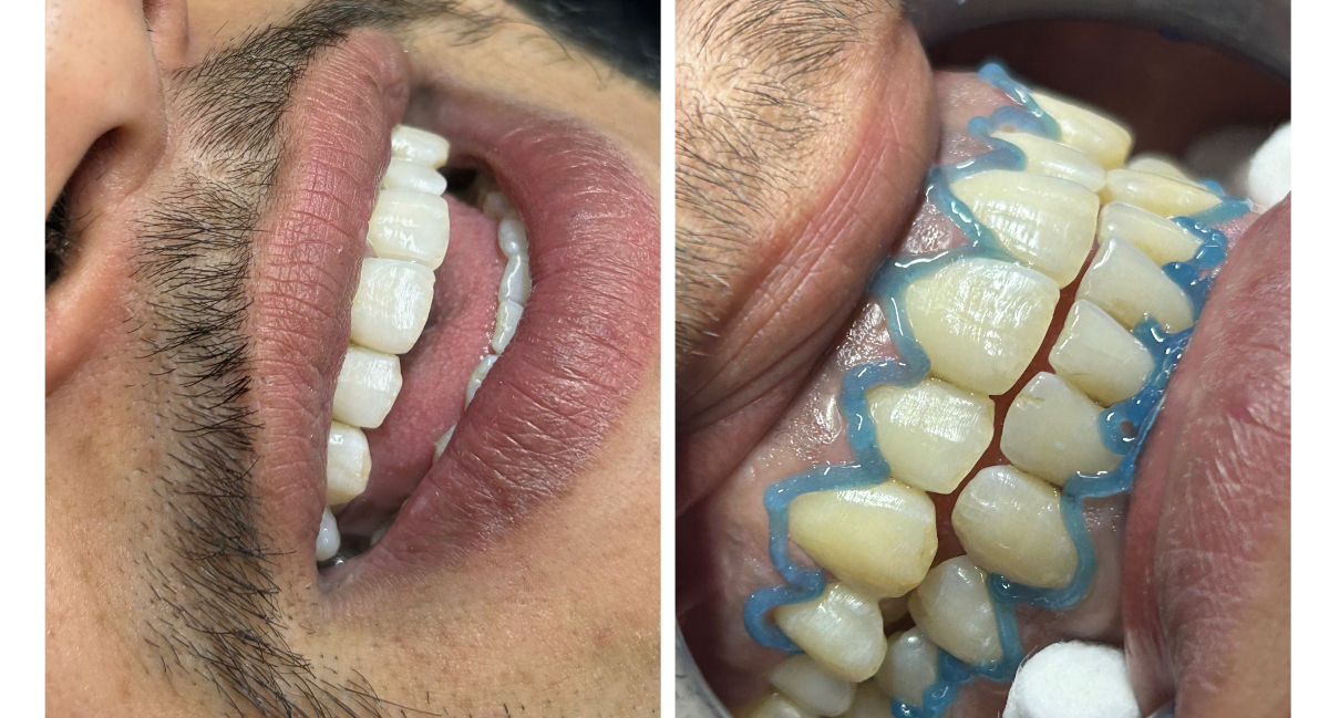 Maison Amoria - réalisation 3